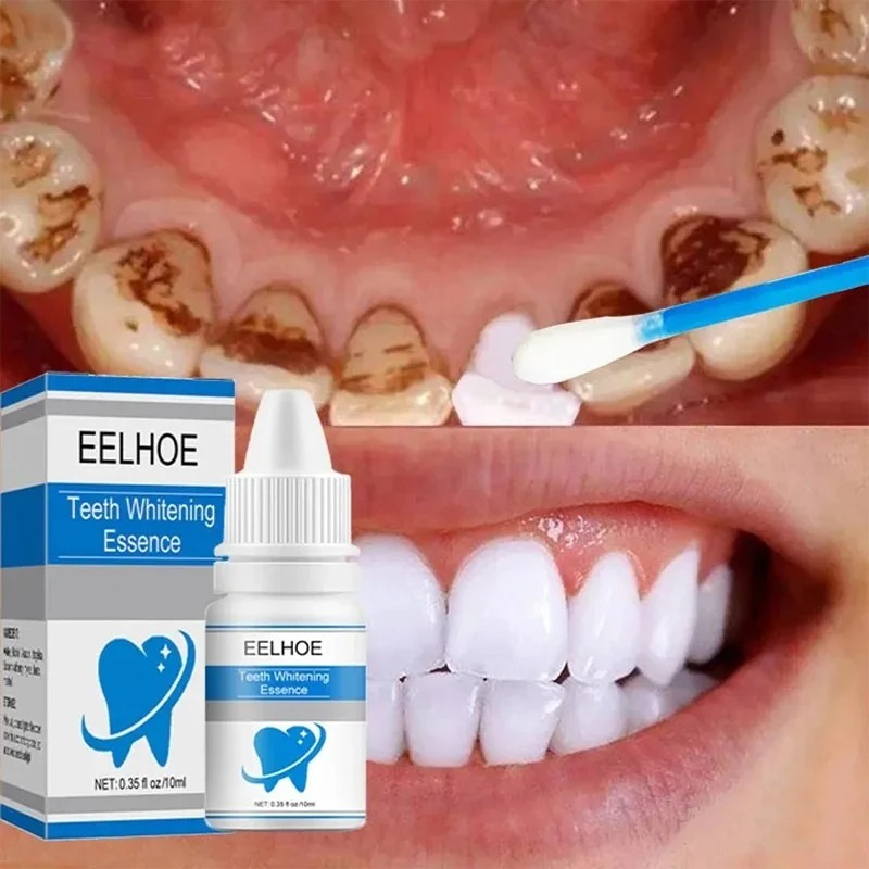 Teeth Whitening Essence – Stain & Plaque Remover – view 5