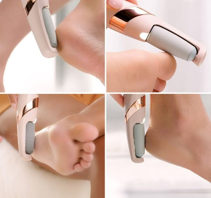 Rechargeable Electric Foot Callus Remover – view 2