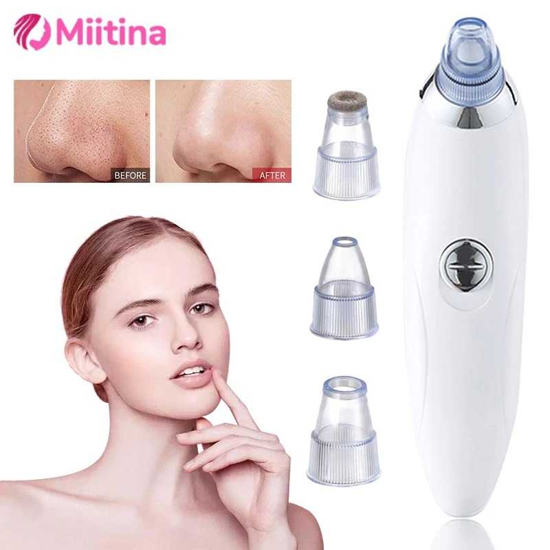 Electric Blackhead Remover – Pore Vacuum – view 6